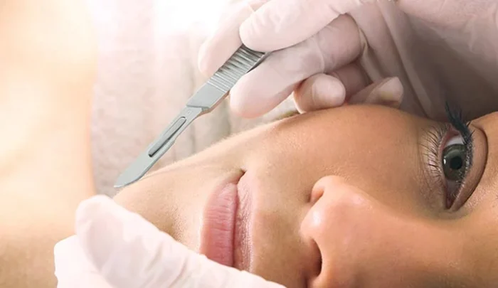dermaplaning sada