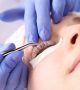 kurz lash lift botox